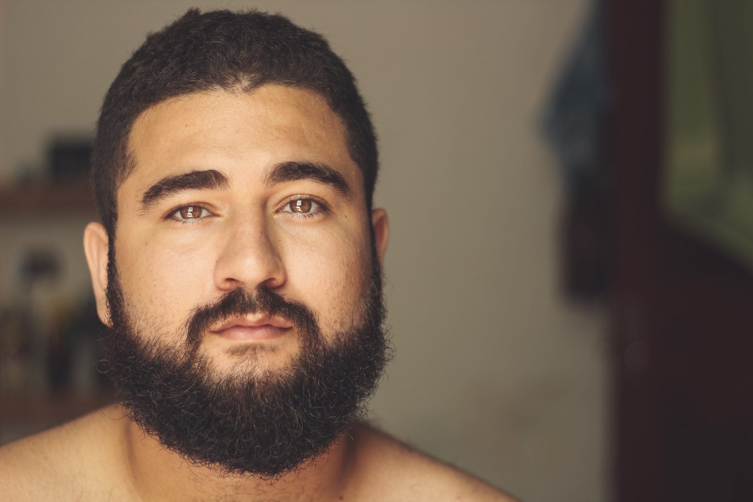 CASE STUDY: My obese gay patient just told me he is a Bear. - Marcus  Greatheart MD MSW